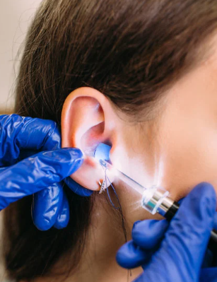 protectores auditivos a medida