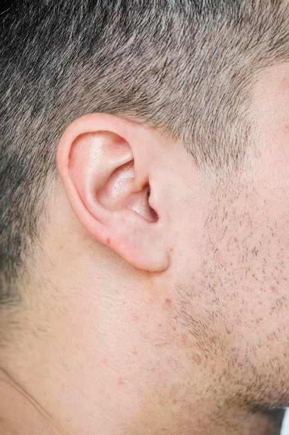 dermatitis-en-la-oreja-1