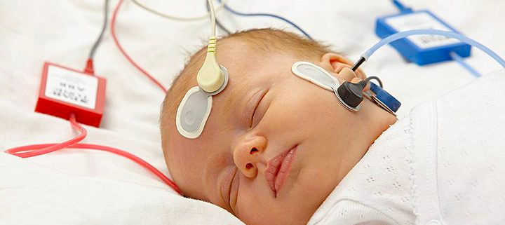 Potenciales_evocados_auditivos